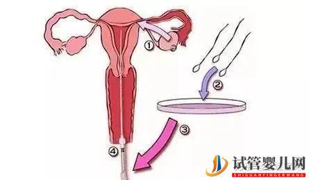 成功的女人,花50萬做試管嬰兒,試管過程你得知道(圖12) 成功的女人,花50萬做試管嬰兒,試管過程你得知道(圖12)
