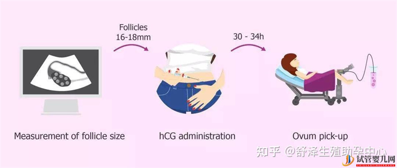 一個(gè)試管嬰兒周期多長(zhǎng)時(shí)間,具體流程怎么樣(圖6) 一個(gè)試管嬰兒周期多長(zhǎng)時(shí)間,具體流程怎么樣(圖6)