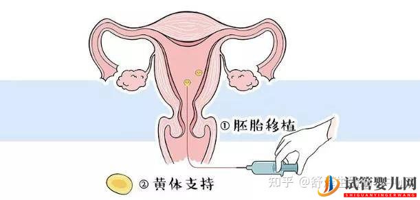 一個(gè)試管嬰兒周期多長(zhǎng)時(shí)間,具體流程怎么樣(圖10) 一個(gè)試管嬰兒周期多長(zhǎng)時(shí)間,具體流程怎么樣(圖10)
