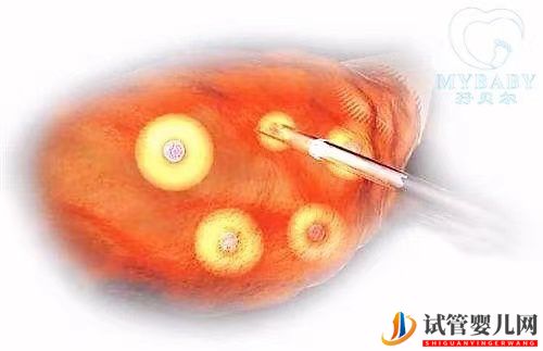 試管嬰兒取卵，數(shù)量越多成功率越高嗎(圖1)