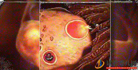 做試管嬰兒,能“定制”生雙胞胎_真相原來如此!(圖1)