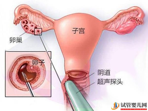 美國(guó)試管專家提高試管成功率的有效方案(圖8) 美國(guó)試管專家提高試管成功率的有效方案(圖8)