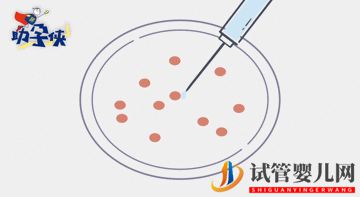 當(dāng)家視頻_試管嬰兒促排和取卵(圖12) 試管嬰兒促排和取卵(圖4)