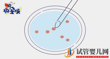 當(dāng)家視頻_試管嬰兒促排和取卵(圖16) 試管嬰兒促排和取卵(圖6)