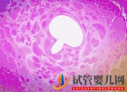 做試管嬰兒到底要花多少錢_幾萬和十幾萬有什么區別(圖11)