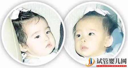 原來這些漂亮明星寶寶都是試管嬰兒!盤點那些做試管(圖7) 原來這些漂亮明星寶寶都是試管嬰兒!盤點那些做試管(圖7)
