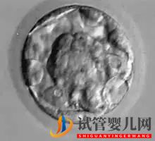 美國試管嬰兒_這樣的囊胚才是極好的(圖9) 美國試管嬰兒_這樣的囊胚才是極好的(圖9)