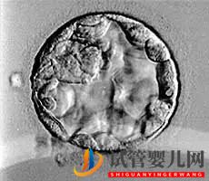 美國試管嬰兒_這樣的囊胚才是極好的(圖18) 美國試管嬰兒_這樣的囊胚才是極好的(圖18)