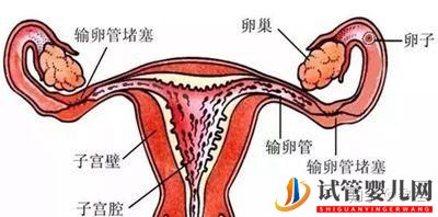輸卵管堵塞還想懷寶寶!能夠做泰國試管嬰兒嗎(圖1)