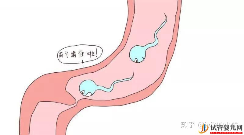 輸卵管堵塞想做試管嬰兒,拿到結果后我哭了(圖3)