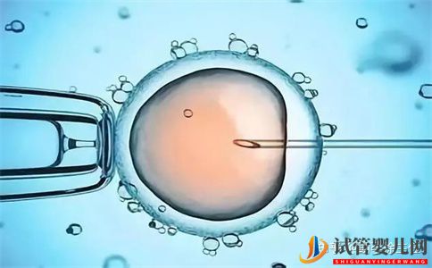 試管嬰兒網(wǎng):做第三代試管嬰兒全過程需要多長時間(圖4) 做第三代試管嬰兒全過程需要多長時間(圖2)