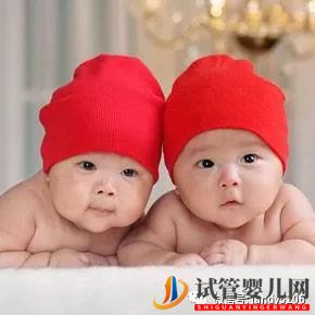你喜歡哪對(duì)雙胞胎小孩？測(cè)你的孩子將來(lái)會(huì)有出息嗎？(圖2)