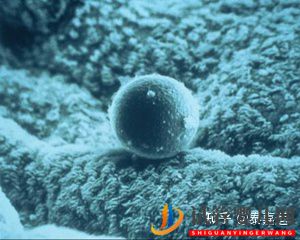 論決定三代試管成功率5大因素之子宮內膜(圖3) 論決定三代試管成功率5大因素之子宮內膜(圖3)