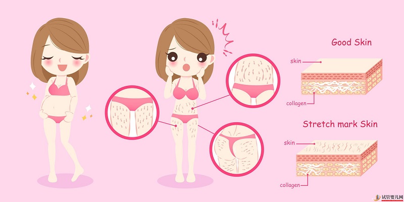 西藏1家試管嬰兒醫(yī)院排名、成功率與費用是否醫(yī)保報銷？(圖2)