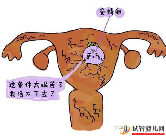 做泰國(guó)試管嬰兒要滿足哪些條件(圖2)