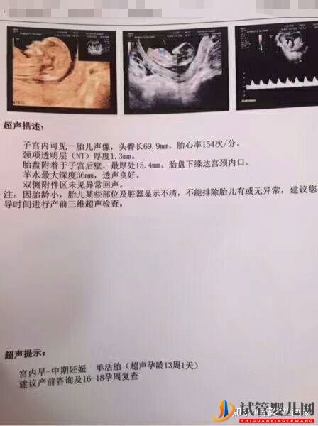 泰國試管嬰兒心路歷程(圖4)