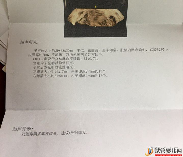 國內(nèi)第三代試管嬰兒到底能不能選男女(圖1)