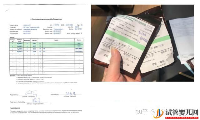 跨境醫療試管崛起,不用中介能不能去泰國試管(圖9) 跨境醫療試管崛起,不用中介能不能去泰國試管(圖9)