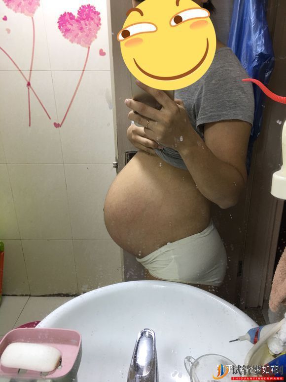 認真臉我覺得泰國試管技術真的不錯(圖4) 認真臉我覺得泰國試管技術真的不錯(圖4)