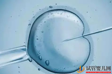 美國(guó)試管嬰兒中的取卵手術(shù)是如何操作的(圖1)