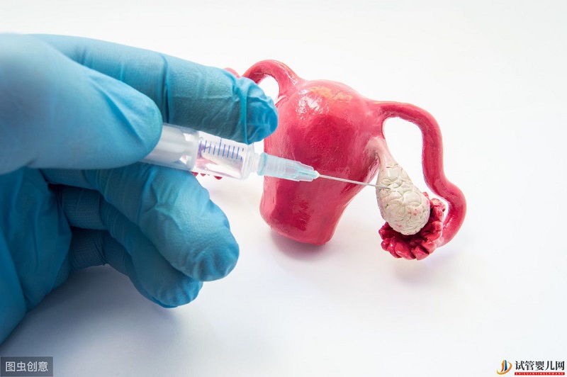 聽說試管嬰兒促排卵會導致女性卵巢早衰？別再謠傳了！(圖1)