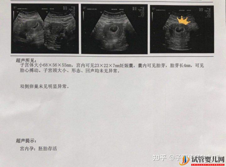 我卵巢早衰AMH特別低,做試管還有希望嗎AMH低(圖4)