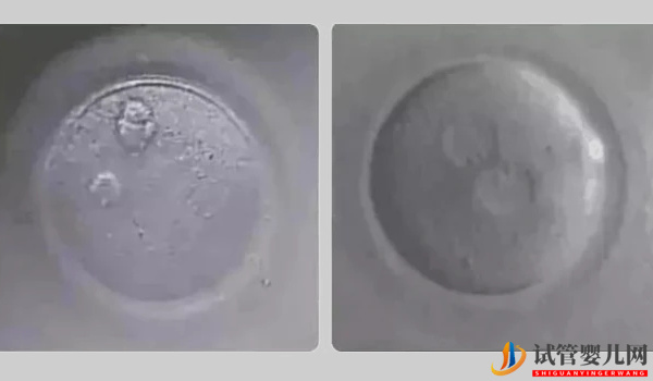 0pn胚胎移植并非不能存活，三種情況告訴你風(fēng)險(xiǎn)大不大(圖2)