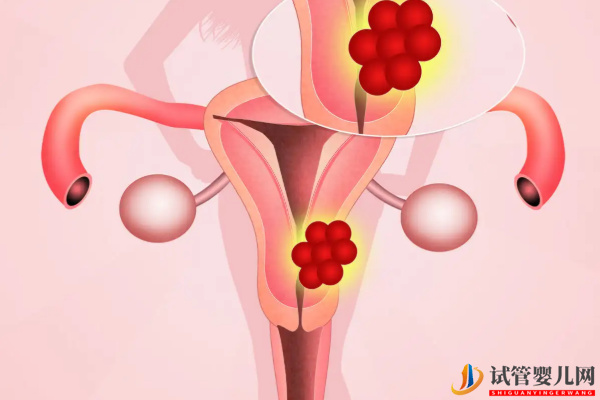 amh0.26做試管還有希望(圖2)