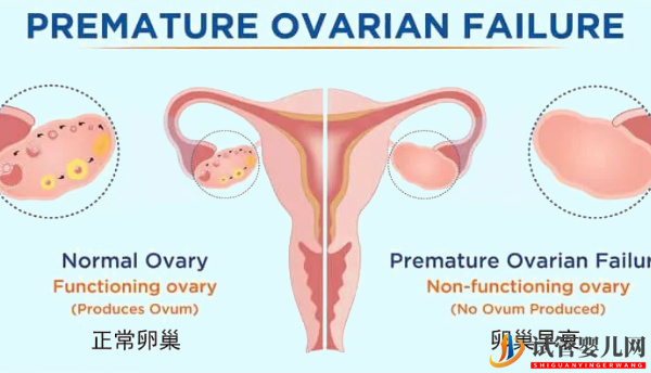卵巢功能不好也可做試管！成功經(jīng)驗(yàn)講述如何把影響縮小(圖1)