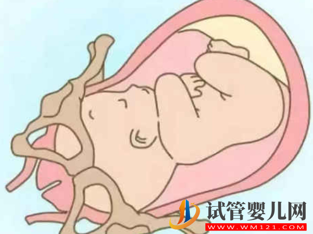一張圖分清全入盆和半入盆區(qū)別，通過(guò)這3個(gè)表現(xiàn)在家可自判(圖1)