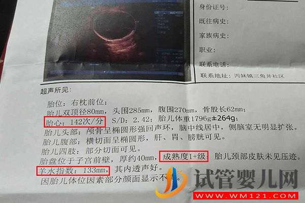bpd、hc、ac、fl正常值對照表一覽，附B超數據看男女方法(圖2)