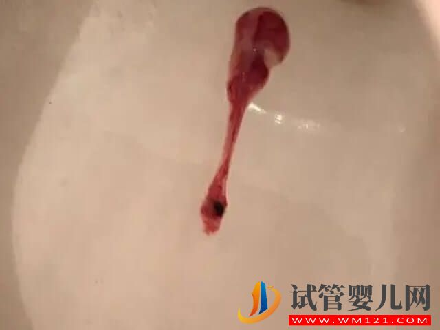 懷孕12周之前突然出現胎停自己會有什么感覺嗎？(圖2)