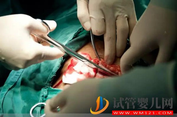 子宮腺肌癥潛伏的5大誘因，生活中防不勝防(圖3)