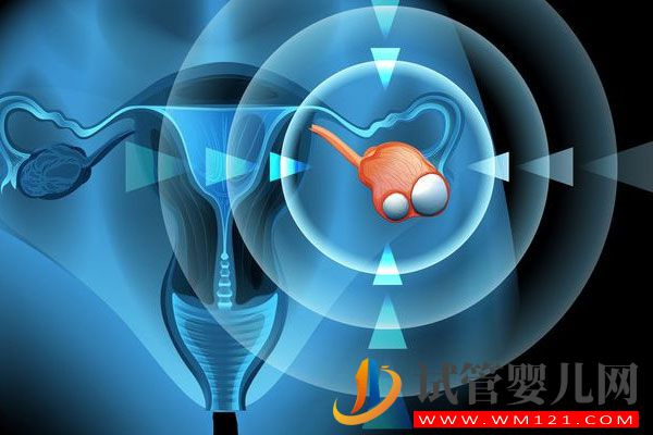 卵巢囊腫對試管助孕有影響嗎?專家告訴你有(圖2) 卵巢囊腫對試管助孕有影響嗎?聽聽專家怎么說(圖2)