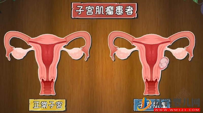 影響試管嬰兒成功率的子宮內環(huán)境有哪些(圖2)