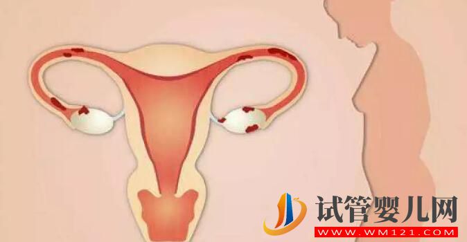 卵巢功能不好能做試管?嬰兒?jiǎn)幔?圖2) 卵巢功能不好能做試管?嬰兒?jiǎn)幔?圖2)