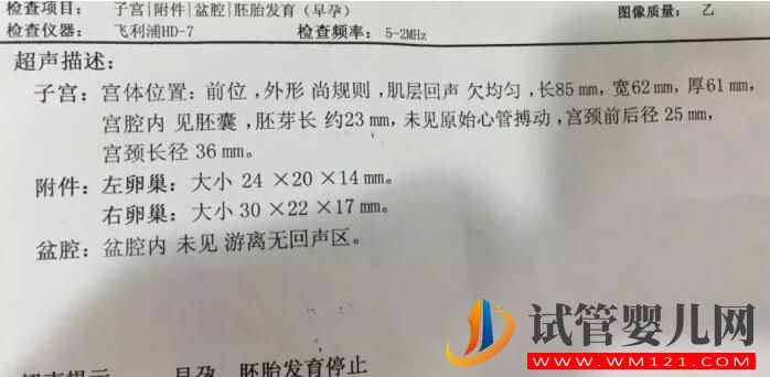 胎停育后能再次懷孕嗎?(圖2) 胎停育后能再次懷孕嗎?(圖2)