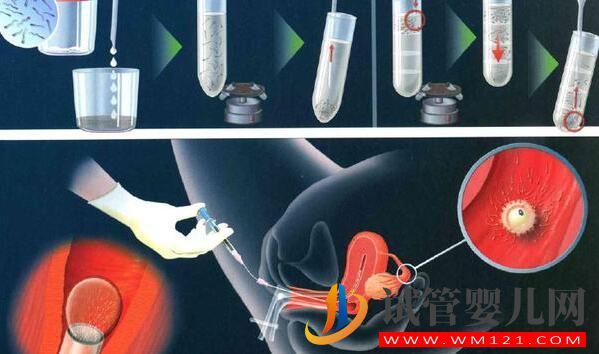 試管嬰兒的出發點和原理是什么？想要了解的進來看看了(圖2)