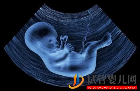試管嬰兒月經(jīng)期要做b超嗎?(圖4) 試管嬰兒月經(jīng)期要做b超嗎?(圖4)