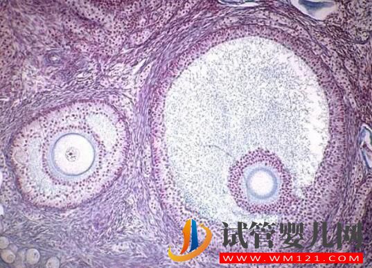 試管嬰兒取卵時空卵泡B超能看出來嗎?(圖2) 試管嬰兒取卵時空卵泡B超能看出來嗎?(圖2)