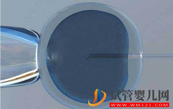 哪些情況?會(huì)建議做試管？做試管嬰兒緩解壓力的方式(圖3)