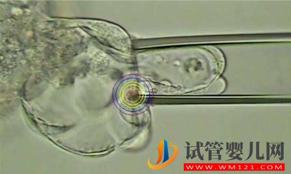 人工授精多次失敗后還可以做試管嬰兒嗎?(圖5) 人工授精多次失敗后還可以做試管嬰兒嗎?(圖5)