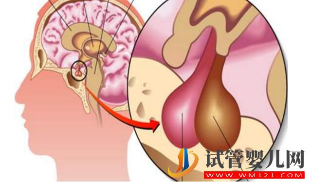 泌乳素高會影響做試管嬰兒嗎?如何比較好?(圖1) 泌乳素高會影響做試管嬰兒嗎?如何比較好?(圖1)