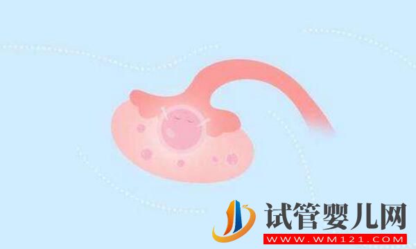 做試管嬰兒促排出現(xiàn)空卵泡是為什么?該怎么辦(圖3) 做試管嬰兒促排出現(xiàn)空卵泡是為什么?該怎么辦(圖3)