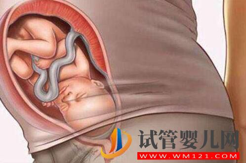 做試管嬰兒的全部流程和費用 全部做完要多長時間(圖2) 做試管嬰兒的全部流程和費用 全部做完要多長時間(圖2)