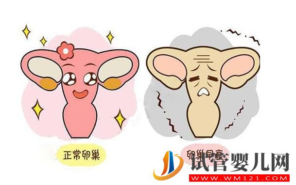 卵巢早衰去泰國做試管嬰兒的成功率如何?(圖2) 卵巢早衰去泰國做試管嬰兒的成功率如何?(圖2)