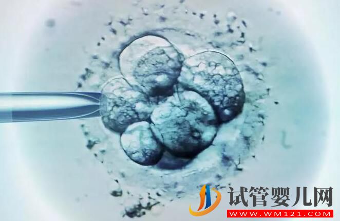 適合做試管嬰兒的人群有哪些?試管成功率受什么影響?(圖4) 適合做試管嬰兒的人群有哪些?試管成功率受什么影響?(圖4)