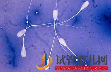 為什么試管的費用會因人而異?如何減少做試管的花費?(圖2) 為什么試管的費用會因人而異?如何減少做試管的花費?(圖2)