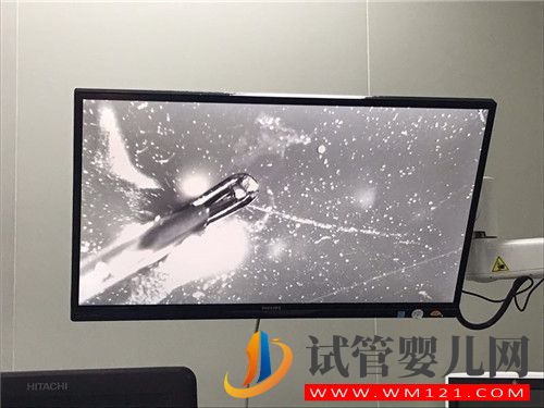 左側卵巢被割除、三次試管失敗她該怎么辦?(圖2) 左側卵巢被割除、三次試管失敗她該怎么辦?(圖2)