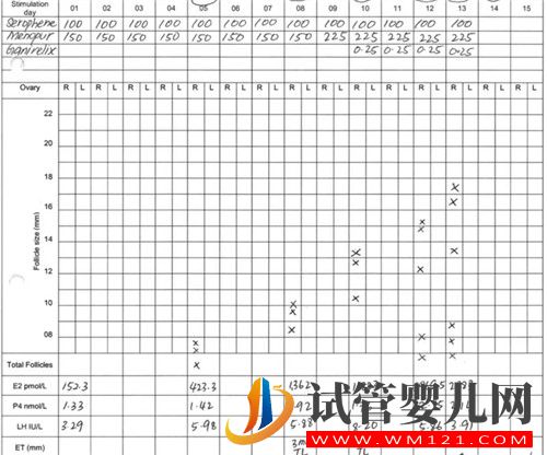 左側卵巢被割除、三次試管失敗她該怎么辦?(圖5) 左側卵巢被割除、三次試管失敗她該怎么辦?(圖5)